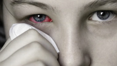 Pink Eye Symptoms and Treatment