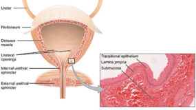 Frequent Urination Treatment in Humble TX