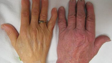 Chronic Disease Management in Humble TX