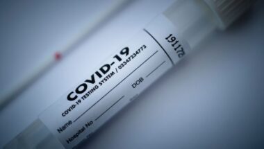 How Long Do I Have To Wait For My COVID-19 Results?